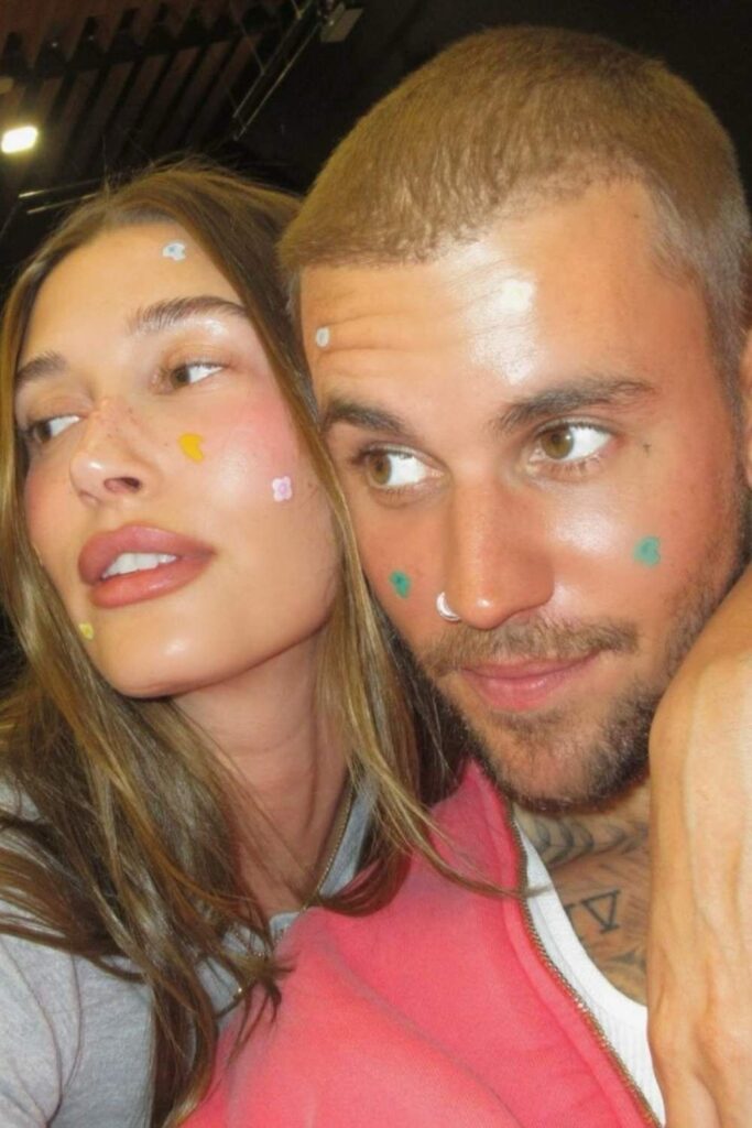 Hailey and Justin Bieber wearing pimple patches